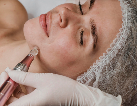 Client receiving microneedling treatment scheduled through medspa software